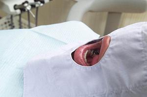 ワキガ治療を行う日本橋の美容皮膚科