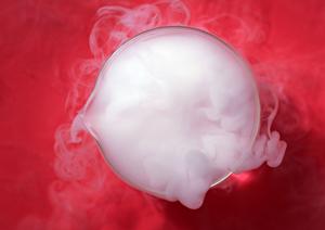 泉北ニュータウンでインプラント